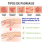 Crema calmante para pieles sensibles Nan Yue, con una fórmula natural a base de plantas